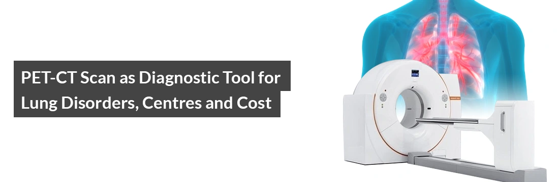 PET-CT Scan as Diagnostic Tool for Lung Disorders, Centres and Cost